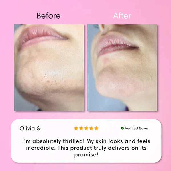 Facial Hair Removal Cream for Women | Upper Lip Chin & Peach Fuzz Remover