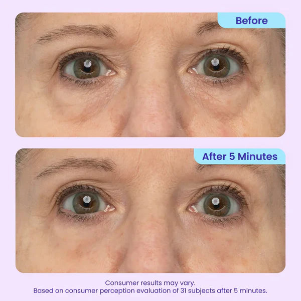 Eye Cream for Dark Circles & Bags | Depuffing Under Eye Gel Stick