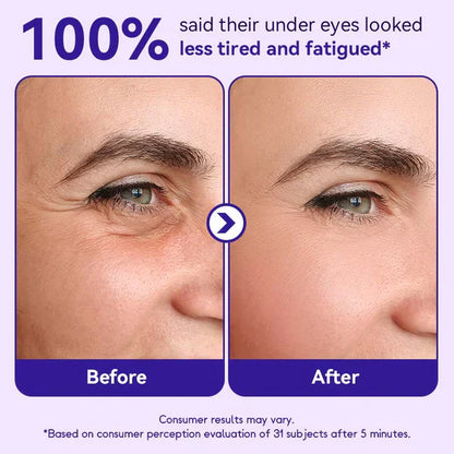Eye Cream for Dark Circles & Bags | Depuffing Under Eye Gel Stick