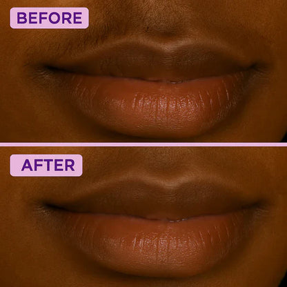 Facial Hair Removal for Women | Upper Lip & Chin Hair Remover Cream