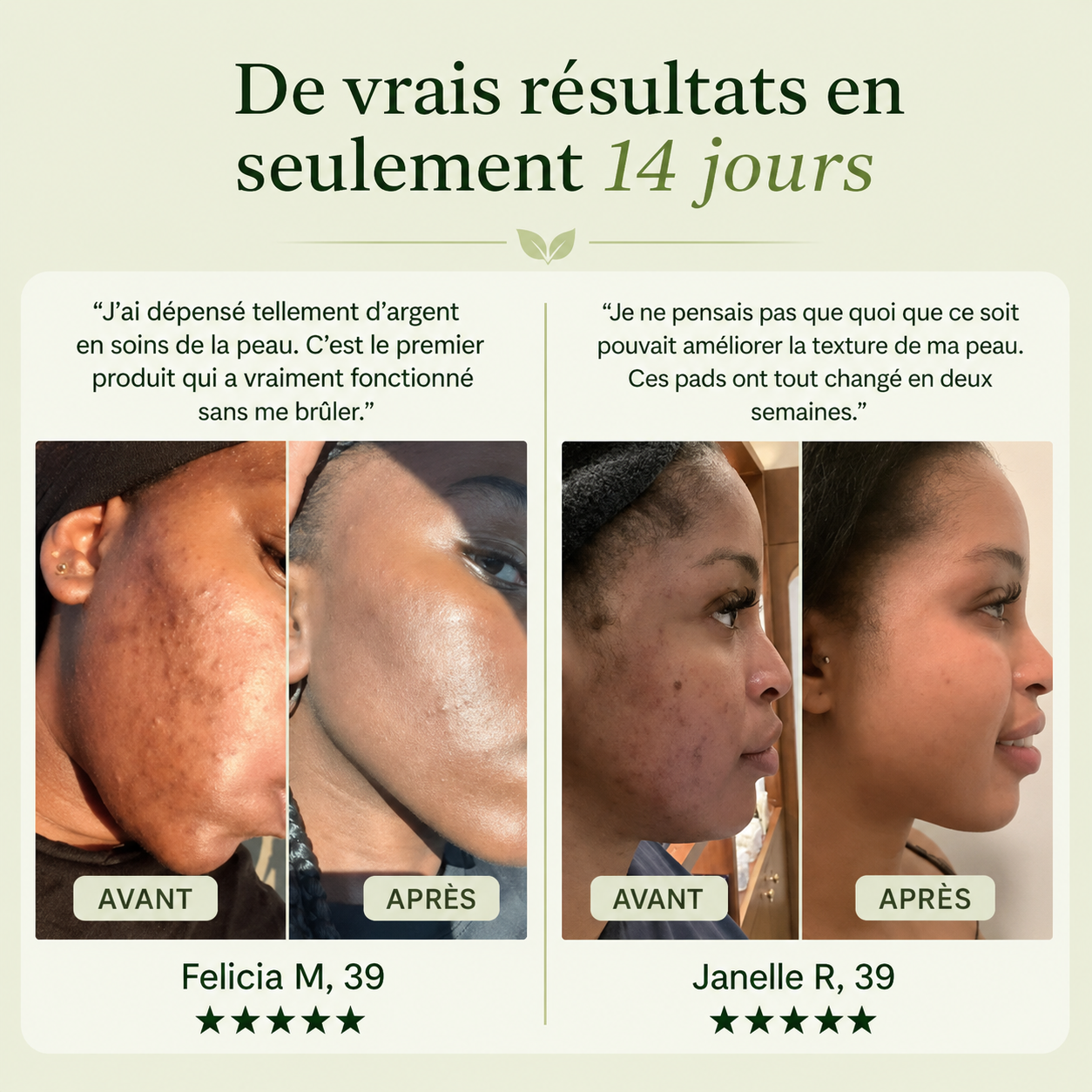 Pads Correcteurs de Taches Brunes pour le Visage | Pads Toniques Coréens contre l’Hyperpigmentation