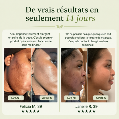 Pads Correcteurs de Taches Brunes pour le Visage | Pads Toniques Coréens contre l’Hyperpigmentation