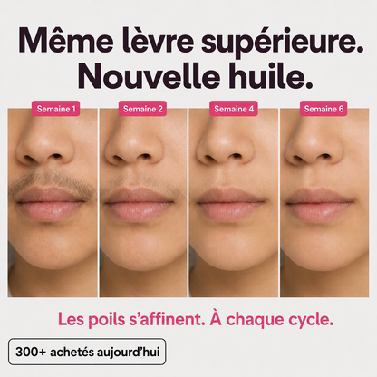 Huile anti-repousse des poils