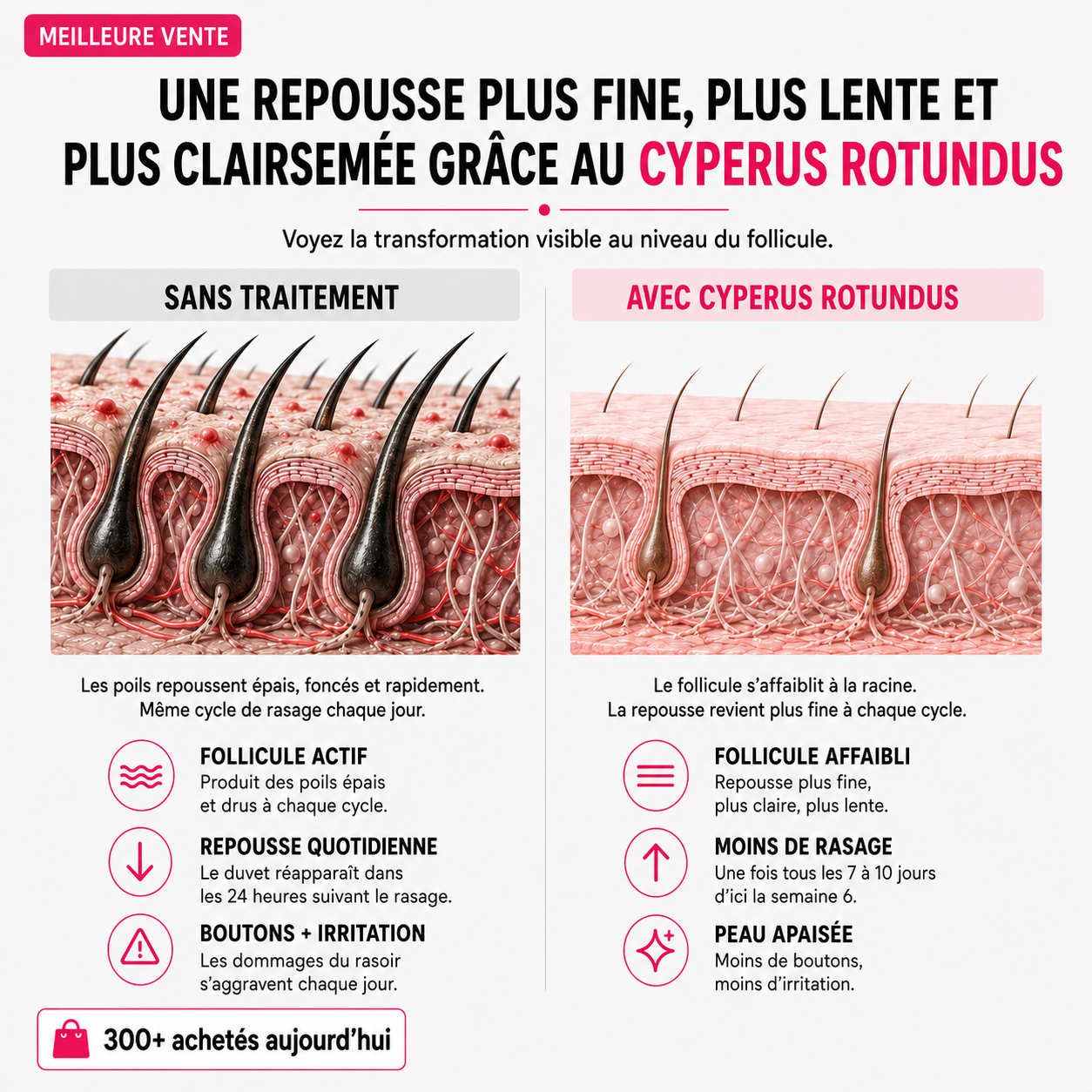 Huile anti-repousse des poils