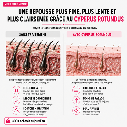 Huile anti-repousse des poils