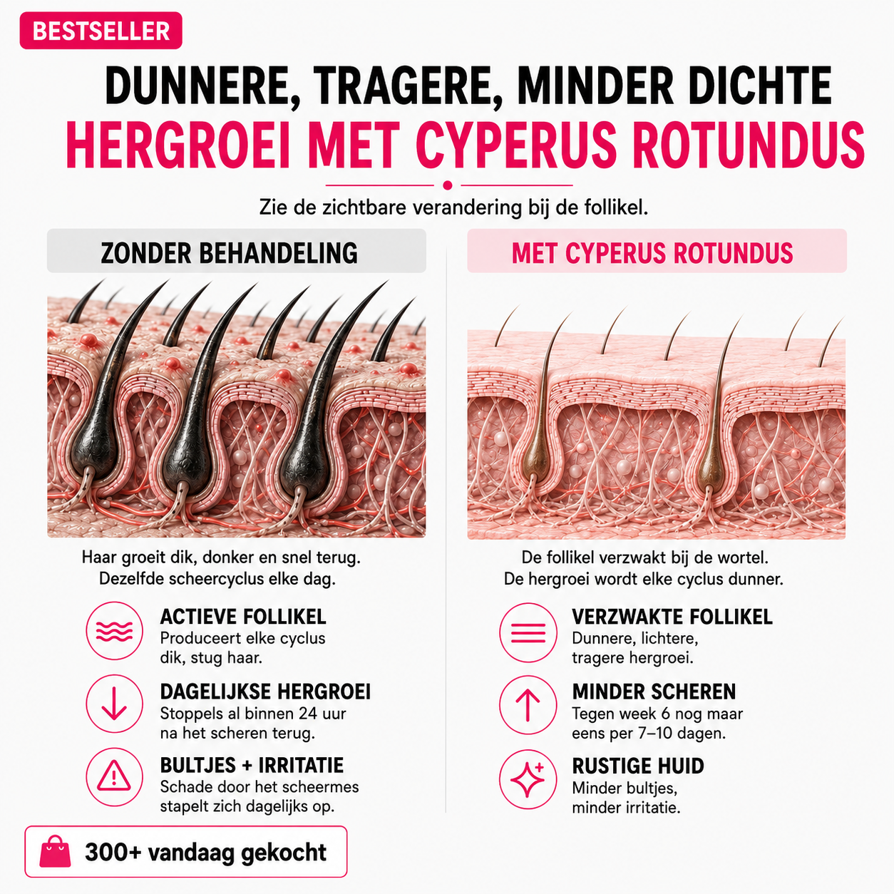 Olie tegen haargroei