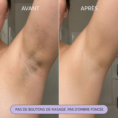Mousse dépilatoire douce pour le corps