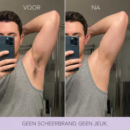 Milde ontharingsmousse voor het lichaam