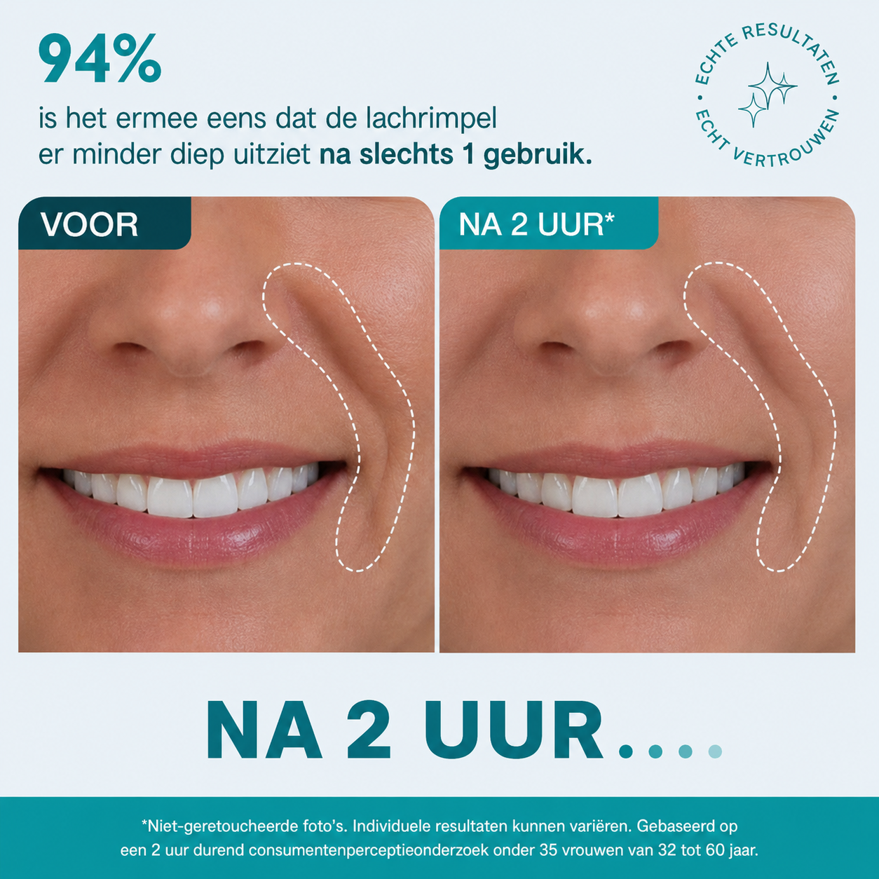 Gezichts- en oogtape met peptiden