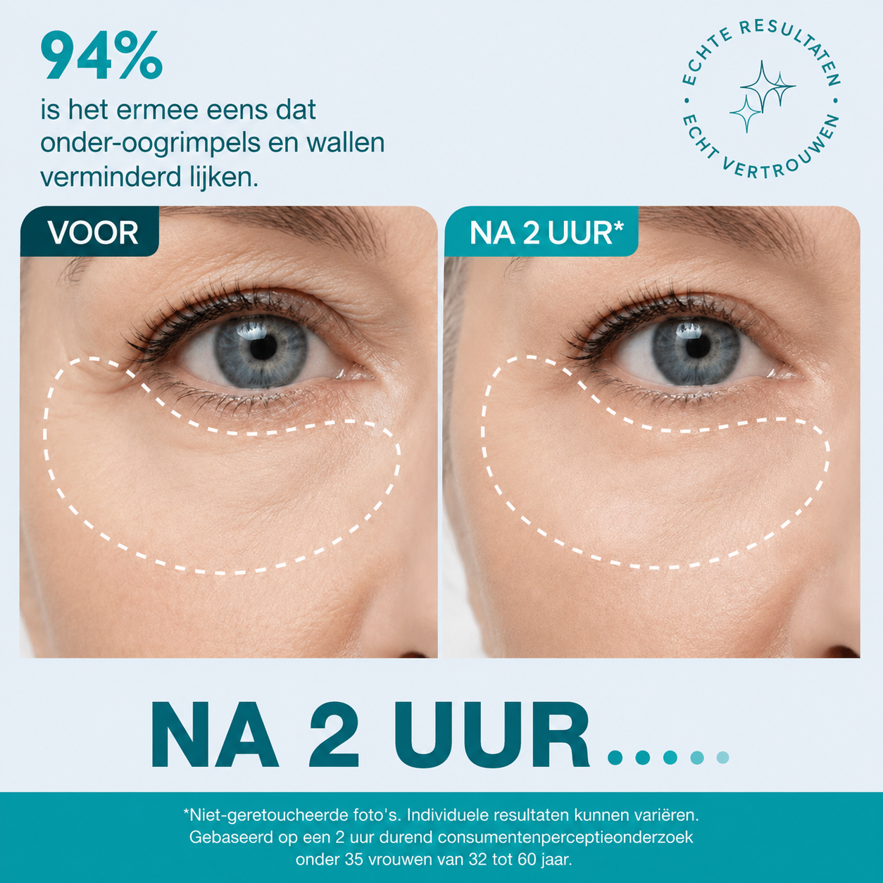 Gezichts- en oogtape met peptiden