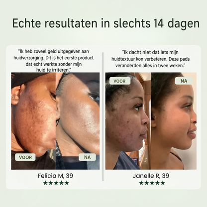 Pads tegen Donkere Vlekken voor het Gezicht | Koreaanse Tonerpads tegen Hyperpigmentatie